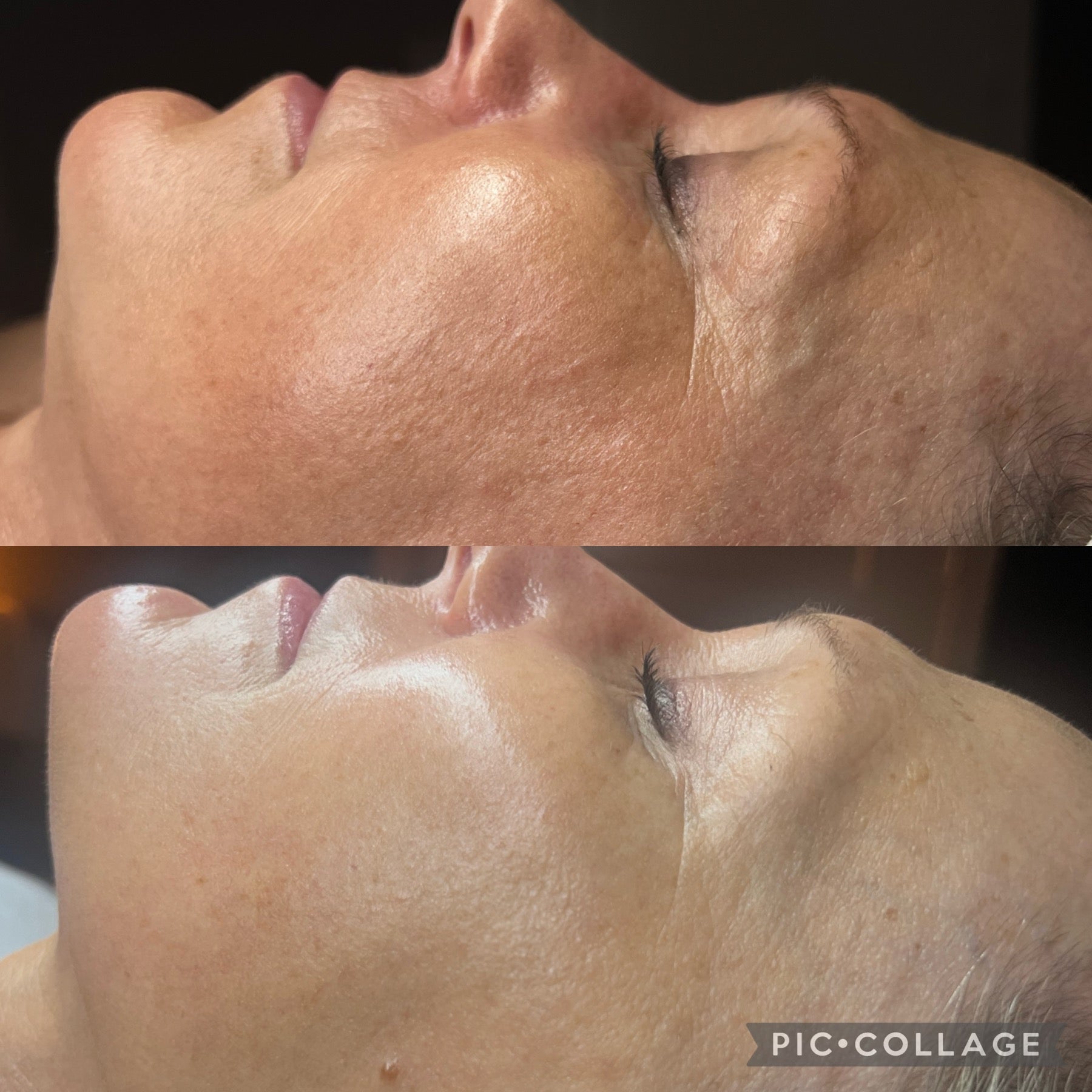 Whats Jet Plasma and why you need it!