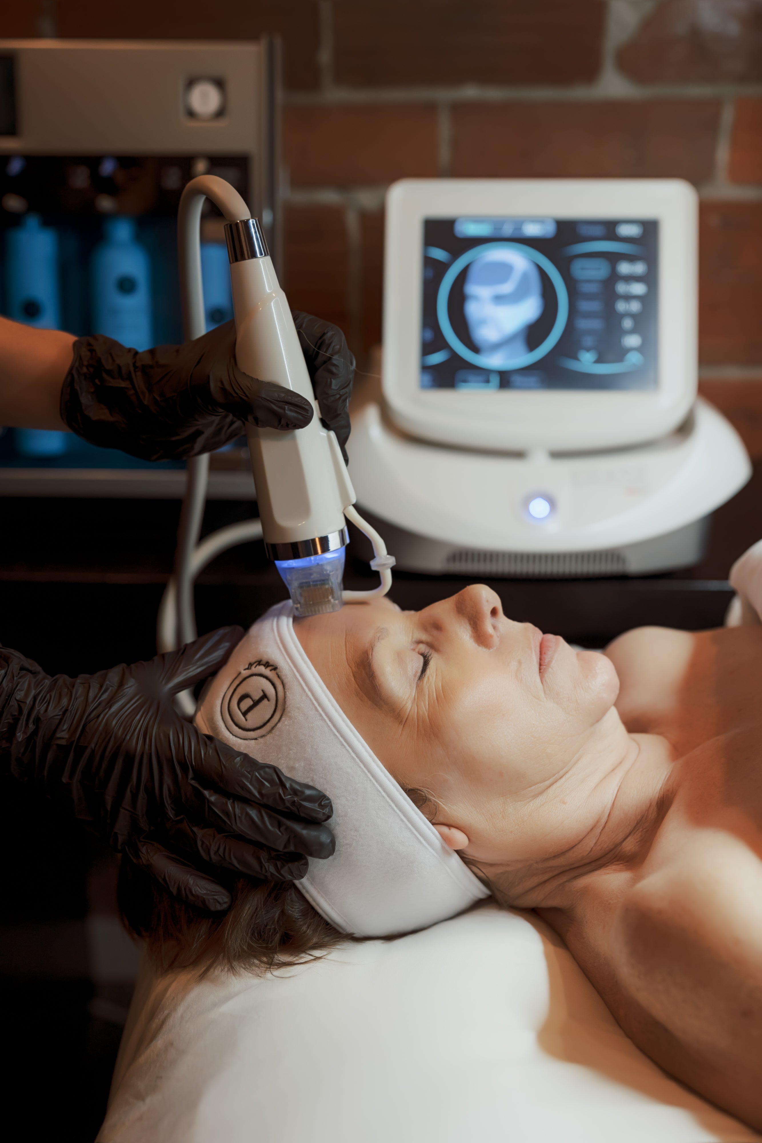 Why Micrneedling may be the thing your skin needs...