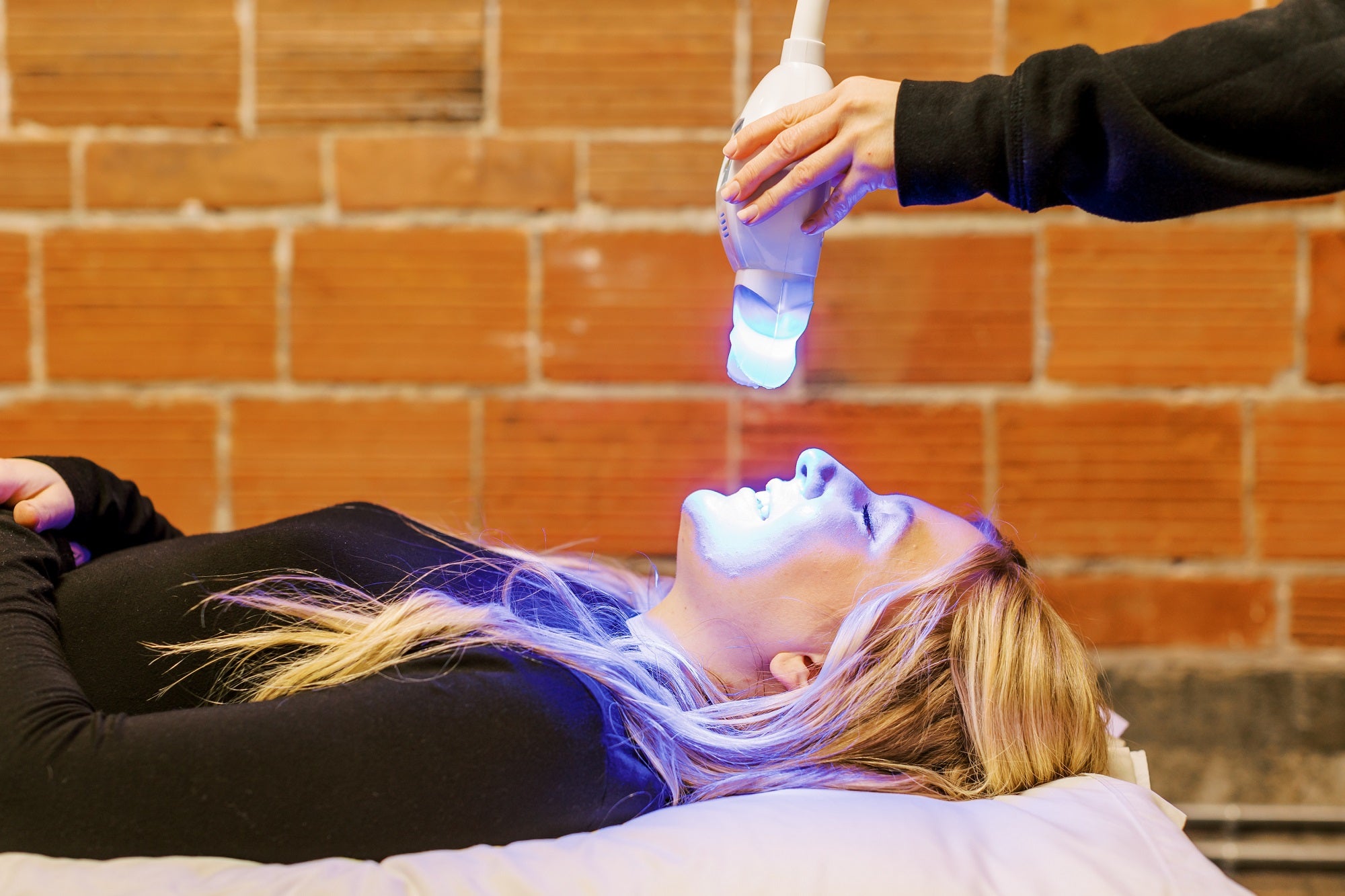 teeth whitening service