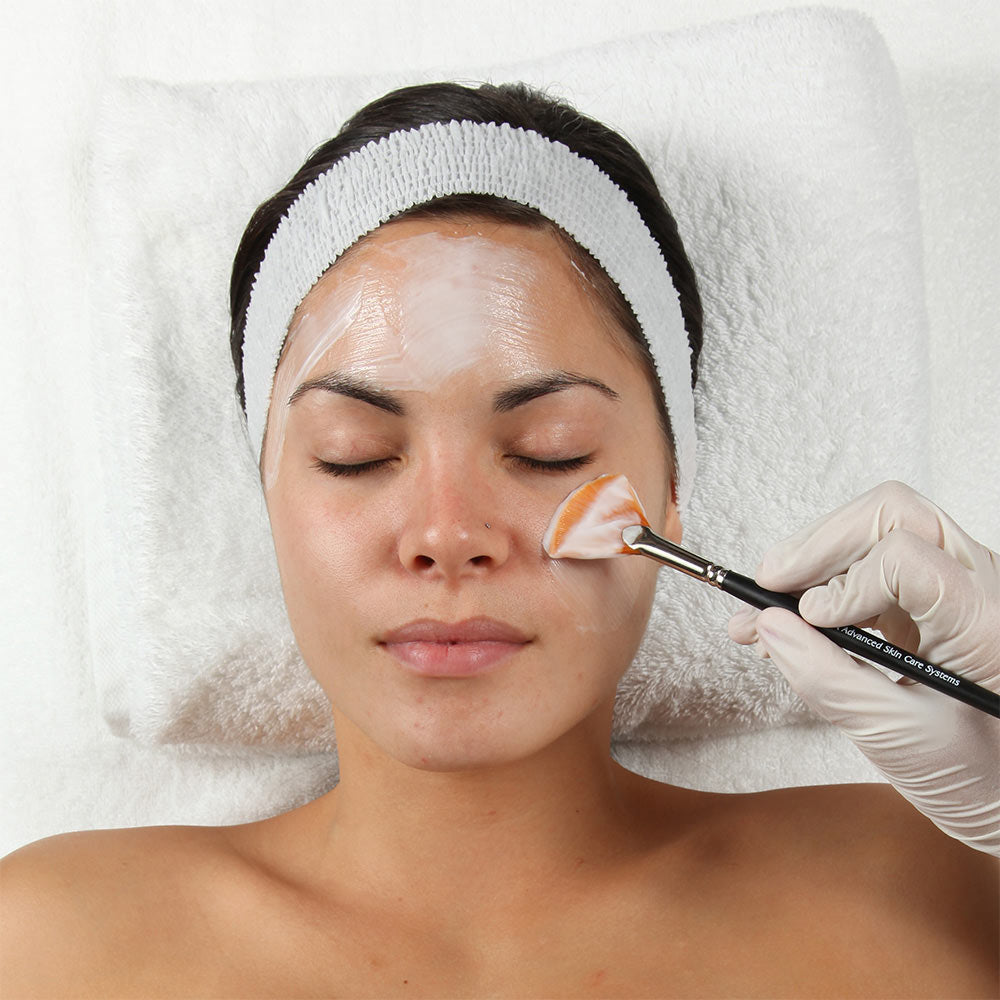 pca peel